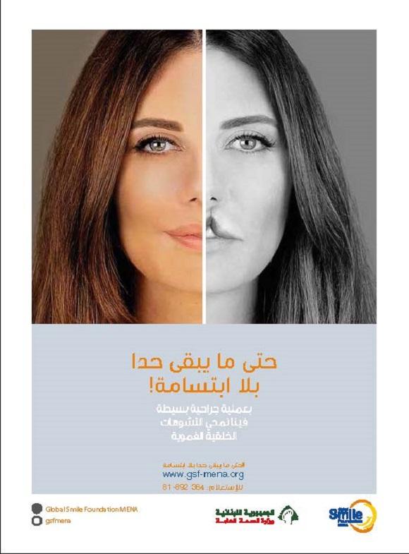 The Cleft Lip National Awareness Campaign 2018