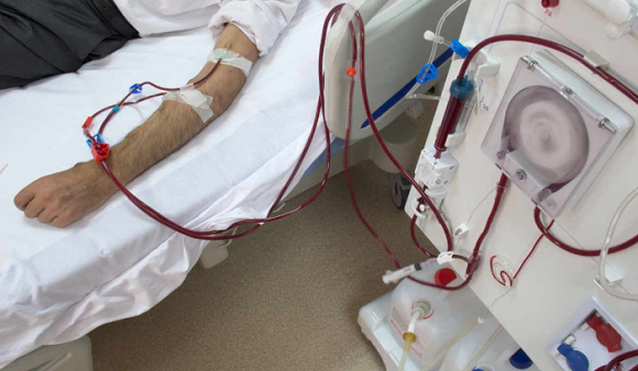 The MoPH Announces Adjustment to Kidney Dialysis Session Tariff